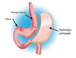 endocrinos en santa cruz Dra. Mónica Vera - Cirugia de Obesidad - Cirugia Bariátrica en Santa Cruz - Bolivia