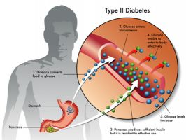 endocrinos en santa cruz Dra. Mónica Vera - Cirugia de Obesidad - Cirugia Bariátrica en Santa Cruz - Bolivia