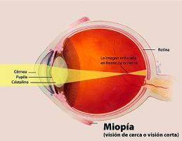 clinicas oftalmologicas en santa cruz Hospital del Ojo